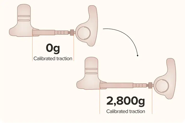 sizegenetics how much tension sizegenetics how much tension